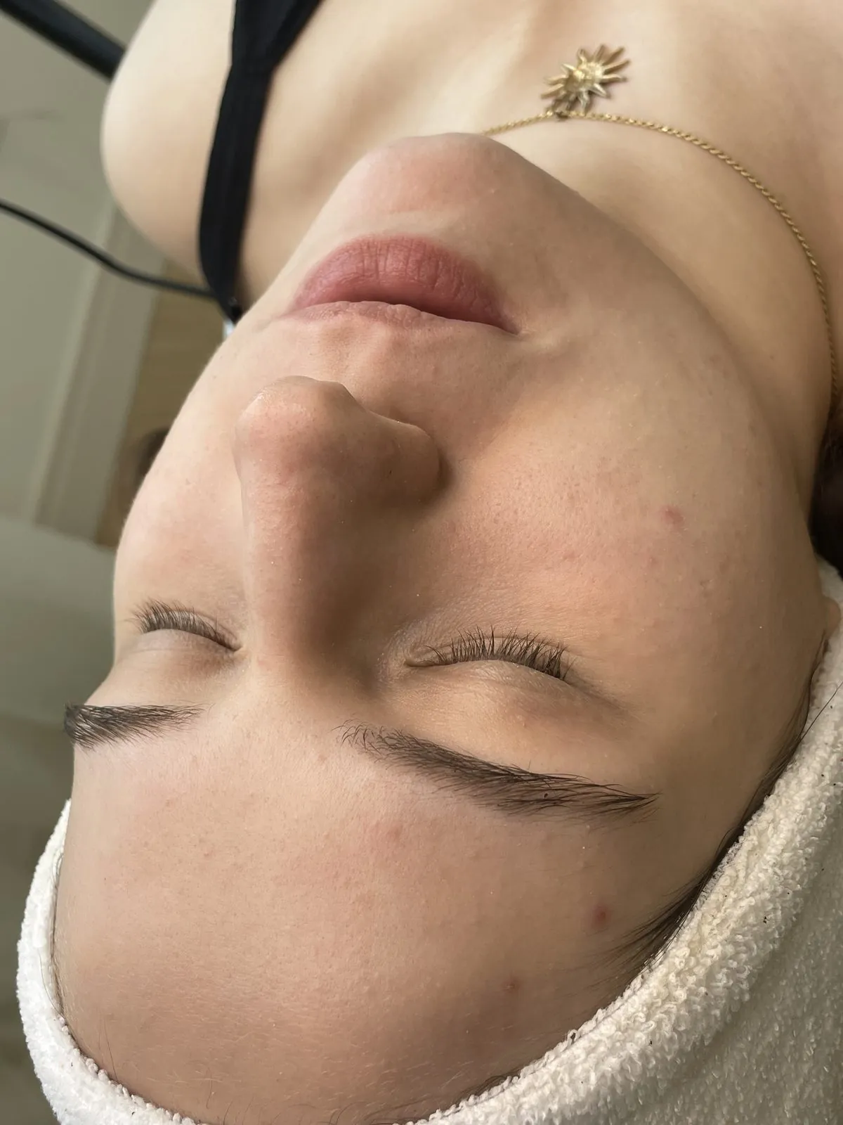 Resultado de Epilação Facial na Carla Soares Beauty, Vila Mariana