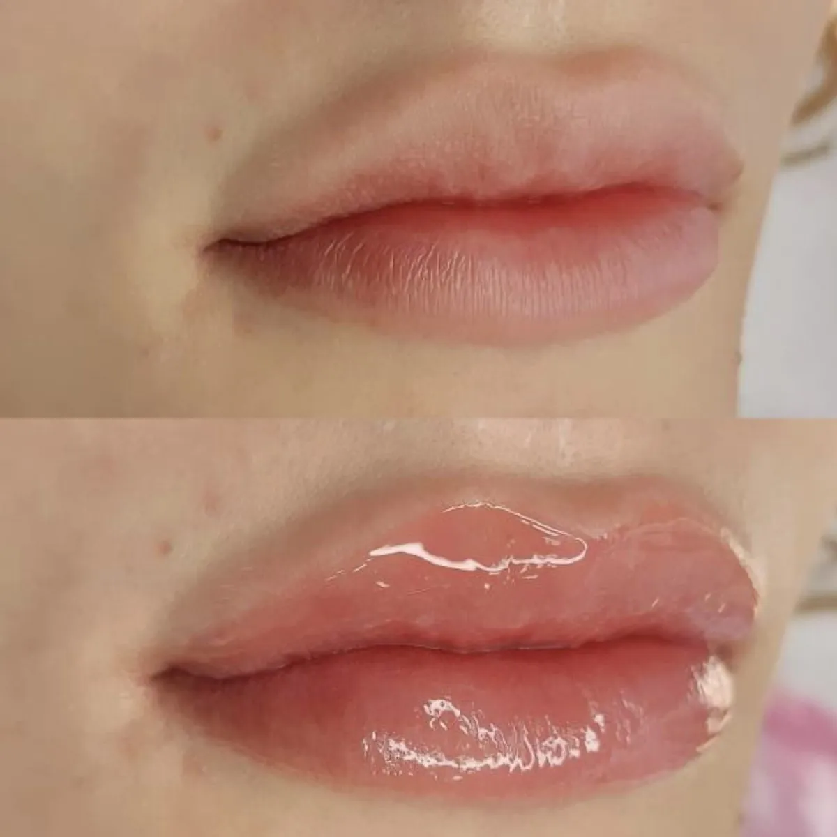 Resultado de Hidra Gloss na Carla Soares Beauty, Vila Mariana