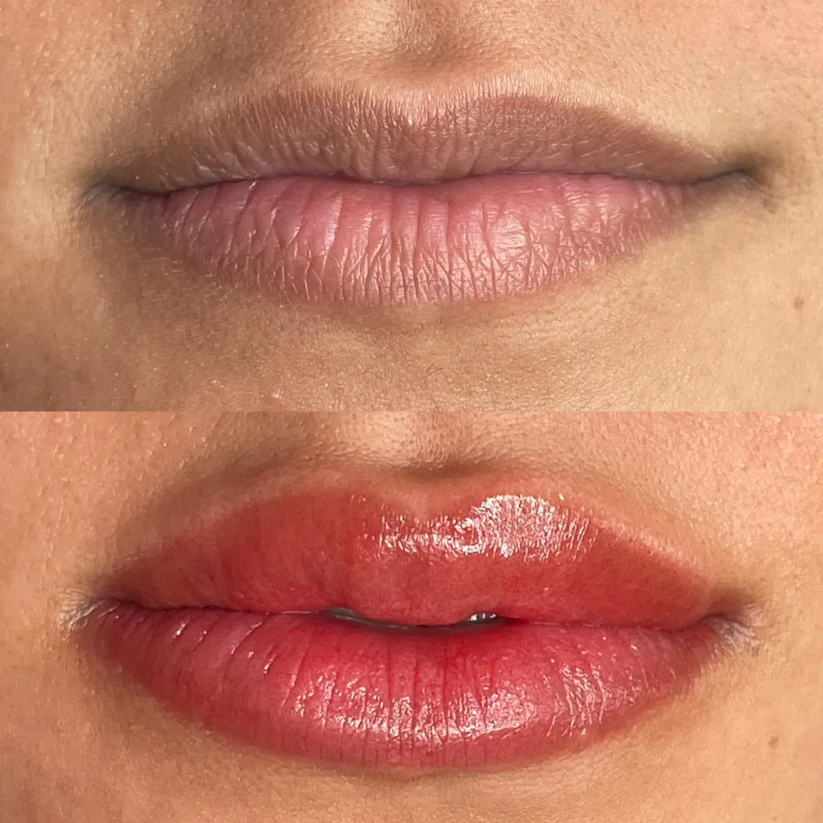Resultado de Neutralização Labial na Carla Soares Beauty, Vila Mariana