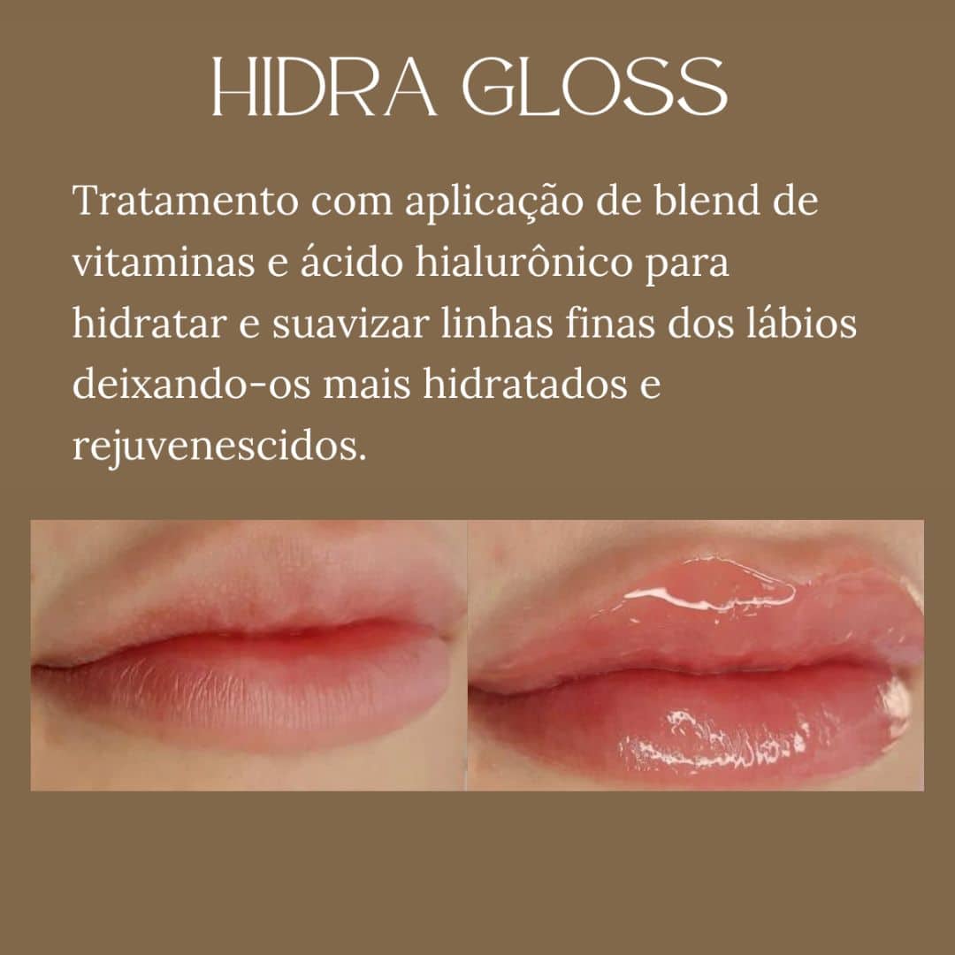 Tratamento labial com vitaminas e ácido hialurônico para lábios mais hidratados e rejuvenescidos.